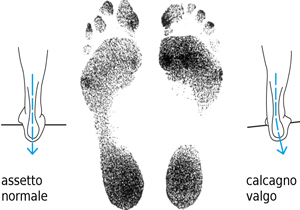Carta podografica Walkable