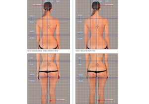 Photo postural test Walkable